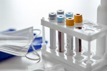 Image showing beakers with coronavirus blood test in holder