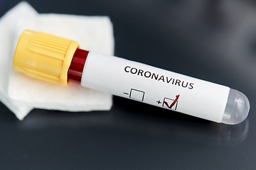 Image showing beaker with coronavirus blood test at laboratory