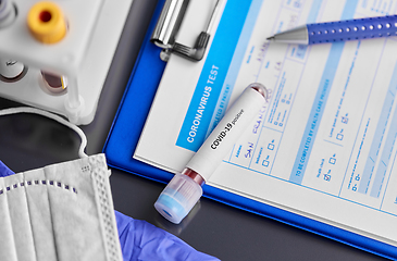 Image showing beaker with coronavirus blood test at hospital