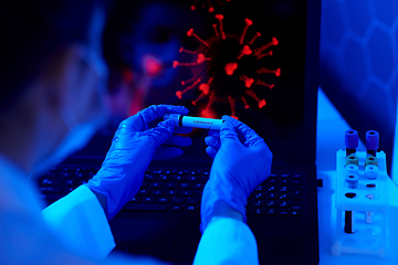 Image showing hand holding beaker with coronavirus blood test