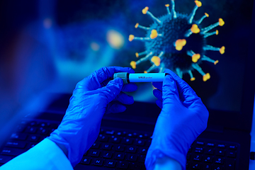 Image showing hand holding beaker with coronavirus blood test