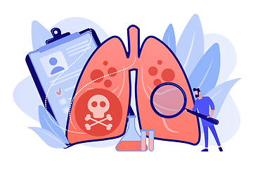 Image showing Lower respiratory infections concept vector illustration.