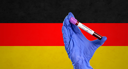 Image showing hand holding beaker with coronavirus blood test