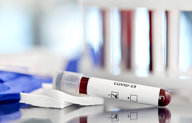 Image showing beaker with coronavirus blood test at laboratory