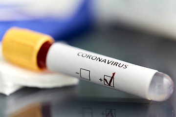 Image showing beaker with coronavirus blood test at laboratory