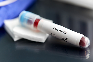 Image showing beaker with coronavirus blood test at laboratory