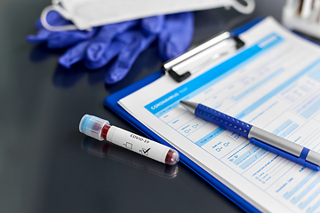 Image showing beaker with coronavirus blood test at hospital