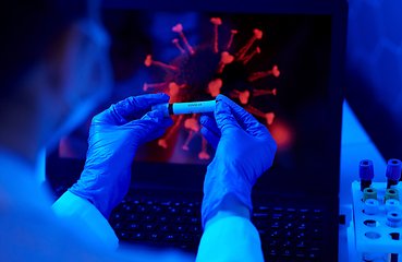 Image showing hand holding beaker with coronavirus blood test