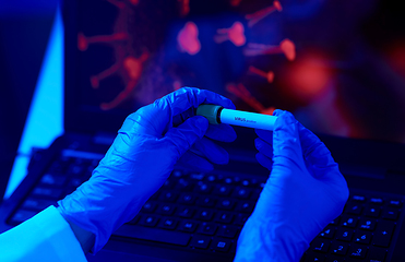 Image showing hand holding beaker with coronavirus blood test