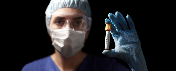 Image showing doctor holding beaker with virus blood test