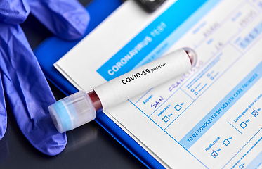 Image showing close up of beaker with coronavirus blood test