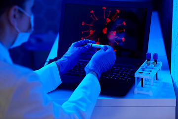 Image showing hand holding beaker with coronavirus blood test