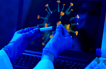 Image showing hand holding beaker with coronavirus blood test