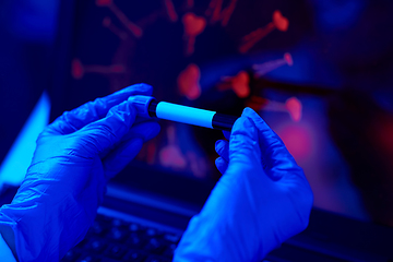 Image showing hand holding beaker with coronavirus blood test