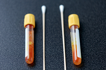 Image showing test tubes with blood plasma and cotton swabs
