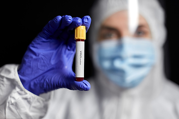 Image showing scientist holding beaker with virus blood test