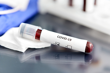 Image showing beaker with coronavirus blood test at laboratory