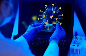 Image showing hand holding beaker with coronavirus blood test