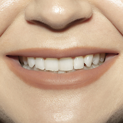 Image showing Close-up female mouth with natural nude gloss lips make-up. Cosmetology, dentistry and beauty care, emotions