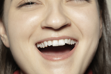 Image showing Close-up female mouth with natural nude gloss lips make-up. Cosmetology, dentistry and beauty care, emotions