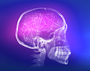 Image showing Human skull X-ray image. Artificial intelligence concept