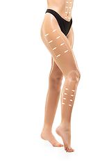 Image showing Cellulite removal plan. The black markings on young woman body preparing for plastic surgery. Concept of body correction