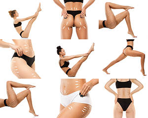 Image showing Cellulite removal plan. The black markings on young women body preparing for plastic surgery. Concept of body correction