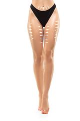 Image showing Cellulite removal plan. The black markings on young woman body preparing for plastic surgery. Concept of body correction