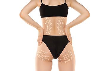 Image showing Cellulite removal plan. The black markings on young woman body preparing for plastic surgery. Concept of body correction