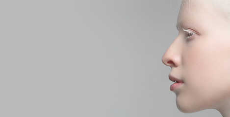 Image showing Close up portrait of beautiful albino woman isolated on studio background. Beauty, fashion, skincare, cosmetics concept. Details.