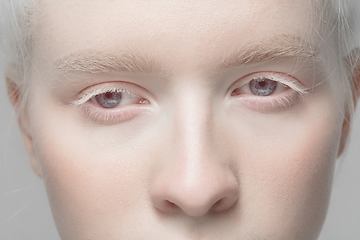 Image showing Close up portrait of beautiful albino woman isolated on studio background. Beauty, fashion, skincare, cosmetics concept. Details.