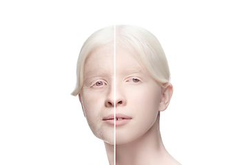 Image showing Comparison. Portrait of beautiful woman with problem and clean skin, aging and youth concept, beauty treatment and lifting.