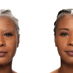 Image showing Comparison. Portrait of beautiful woman with problem and clean skin, aging and youth concept, beauty treatment and lifting.