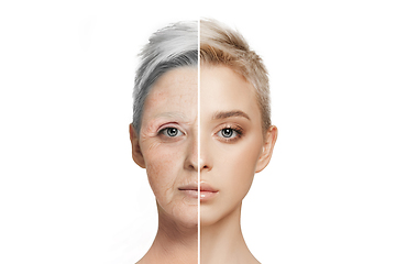 Image showing Comparison. Portrait of beautiful woman with problem and clean skin, aging and youth concept, beauty treatment and lifting.