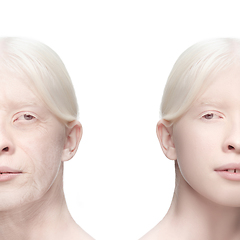 Image showing Comparison. Portrait of beautiful woman with problem and clean skin, aging and youth concept, beauty treatment and lifting.