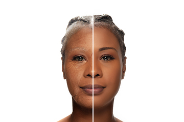 Image showing Comparison. Portrait of beautiful woman with problem and clean skin, aging and youth concept, beauty treatment and lifting.