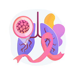 Image showing Lung cancer abstract concept vector illustration.