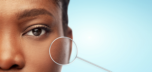 Image showing close up of african woman skin in magnifier