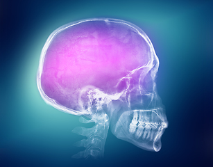 Image showing Human skull X-ray image