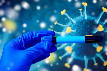 Image showing hand holding beaker with coronavirus blood test