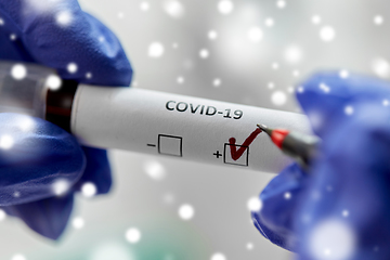 Image showing hand holding beaker with coronavirus blood test