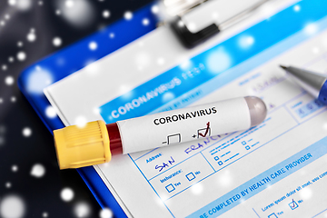 Image showing close up of beaker with coronavirus blood test