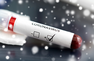 Image showing beaker with coronavirus blood test at laboratory