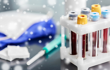 Image showing beakers with blood tests, syringe, gloves and mask