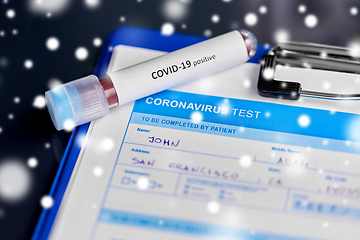 Image showing close up of beaker with coronavirus blood test