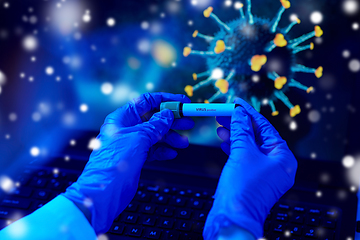 Image showing hand holding beaker with coronavirus blood test