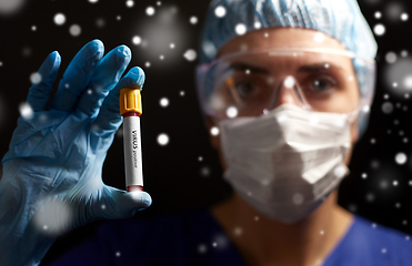 Image showing doctor holding beaker with virus blood test