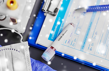 Image showing beaker with coronavirus blood test at hospital