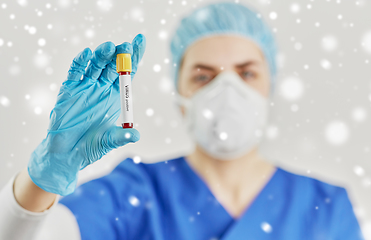 Image showing doctor holding beaker with virus blood test