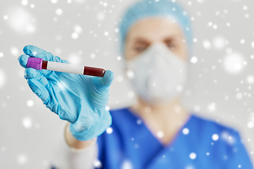 Image showing close up of doctor holding beaker with blood test